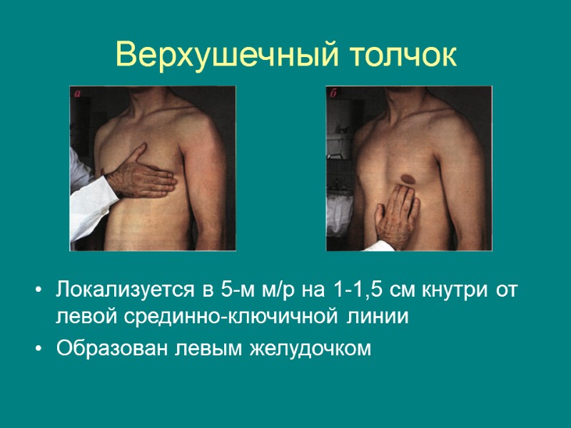 Верхушечный толчок Локализуется в 5-м м/р на 1-1,5 см кнутри от левой срединно-ключичной линии